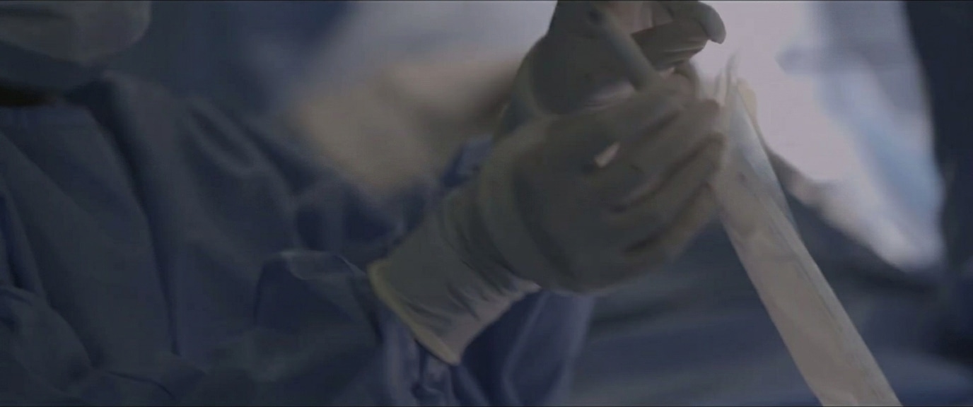 beating heart bypass image