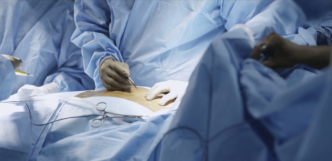 cardiac surgery image